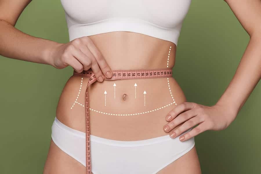 Liposuction Miami FL