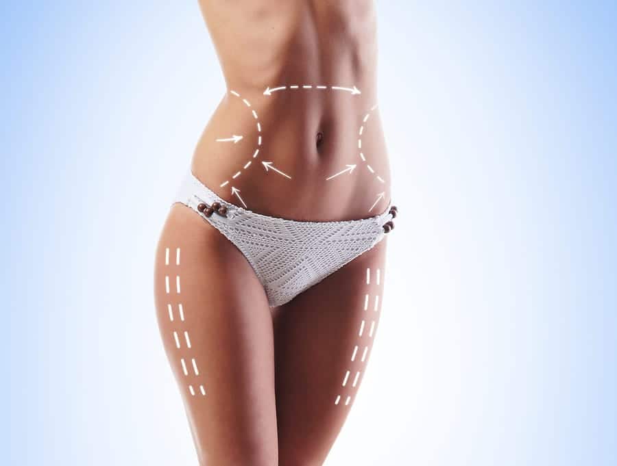 Liposuction Miami