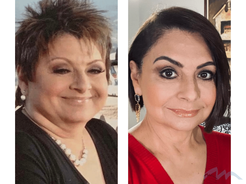 Dr. Wolf's Facelift Patients Miami Plastic Surgery